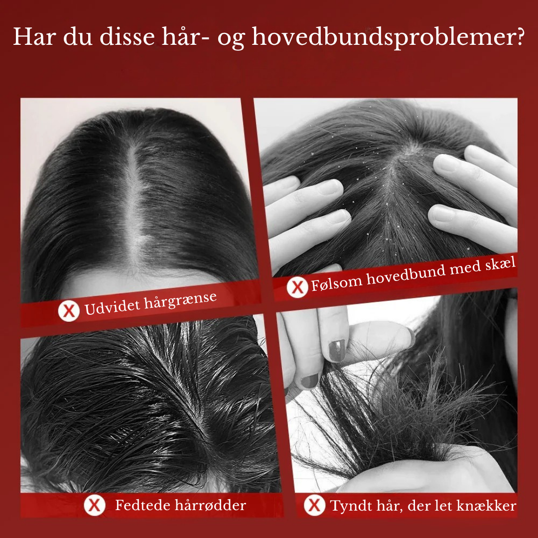 ScalpFlow™ 3-i-1 Hårfornyer: Rødt Lys Terapi kombineret med dybdegående Æltende Massage.