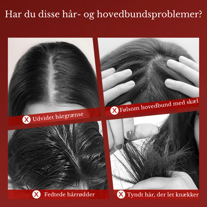 ScalpFlow™ 3-i-1 Hårfornyer: Rødt Lys Terapi kombineret med dybdegående Æltende Massage.